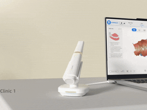shining-3d-dental-aoralscan-elite-wirless